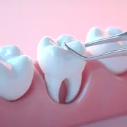 Stomatochirurgie_NAHRADA